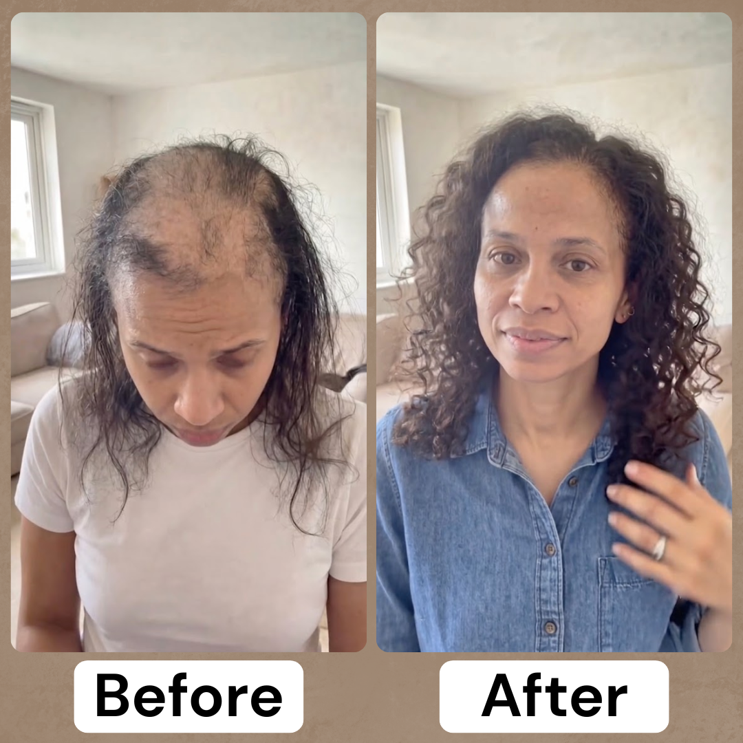 Velné Advanced Batana Hair Regrowth Therapy